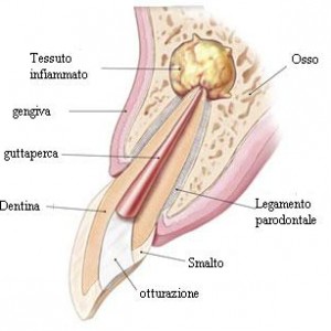 Chirurgia Edontica