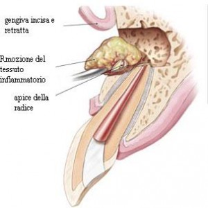 Chirurgia Edontica