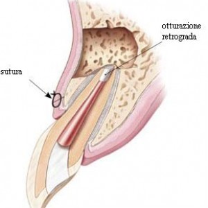 Chirurgia Edontica