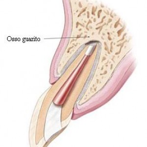 Chirurgia Edontica